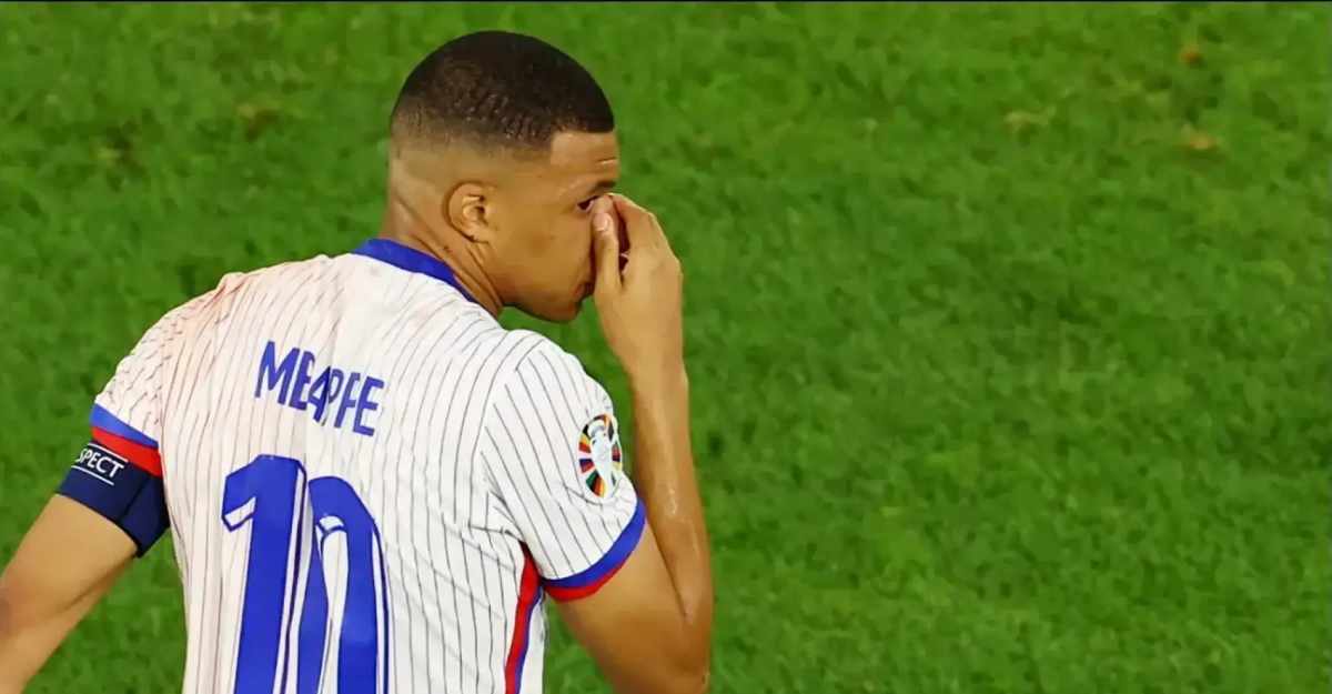 ¿Cuándo volverá a jugar Kylian Mbappé en la Eurocopa-2024? Después de la fractura en la nariz. Foto: AFP